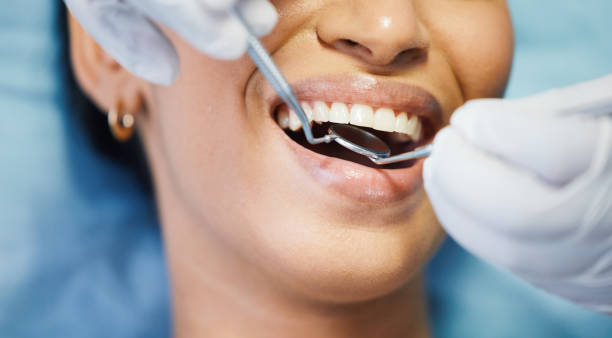 Best Emergency Dentist for Special Needs Patients in San Angelo, TX