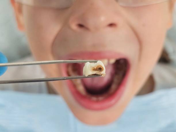 Best Mobile Emergency Dentist in San Angelo, TX